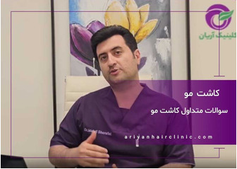 سوالات متداول در مورد کاشت مو